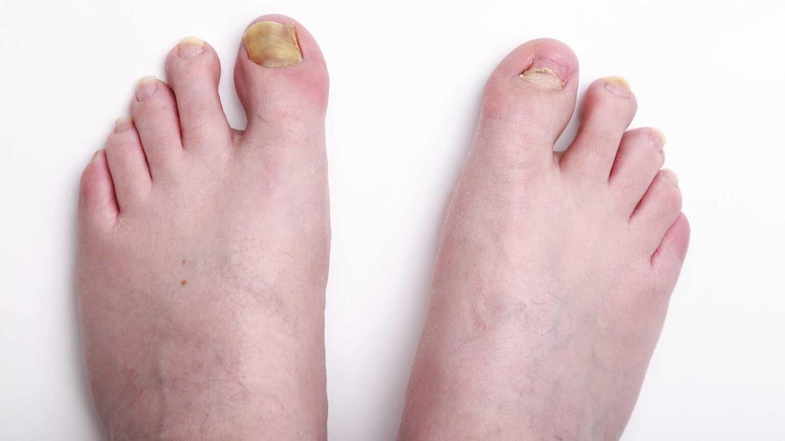 Disregarding the Suffering 21 Painful Problems That Are Often